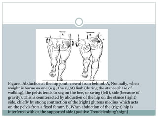 Figure . Abduction at the hip joint, viewed from behind. A, Normally, when 
weight is borne on one (e.g., the right) limb (during the stance phase of 
walking), the pelvis tends to sag on the free, or swing (left), side (because of 
gravity). This is counteracted by abduction of the hip on the stance (right) 
side, chiefly by strong contraction of the (right) gluteus medius, which acts 
on the pelvis from a fixed femur. B, When abduction of the (right) hip is 
interfered with on the supported side (positive Trendelenburg's sign) 
 