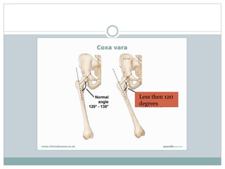 Less then 120 
degrees 
Less 
then 120 
 
