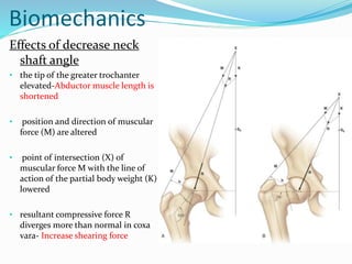 Biomechanics
Effects of decrease neck
shaft angle
• the tip of the greater trochanter
elevated-Abductor muscle length is
shortened
• position and direction of muscular
force (M) are altered
• point of intersection (X) of
muscular force M with the line of
action of the partial body weight (K)
lowered
• resultant compressive force R
diverges more than normal in coxa
vara- Increase shearing force
 