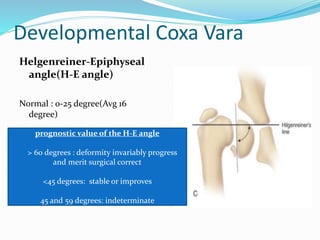 Developmental Coxa Vara
Helgenreiner-Epiphyseal
angle(H-E angle)
Normal : 0-25 degree(Avg 16
degree)
prognostic value of the H-E angle
> 60 degrees : deformity invariably progress
and merit surgical correct
<45 degrees: stable or improves
45 and 59 degrees: indeterminate
 