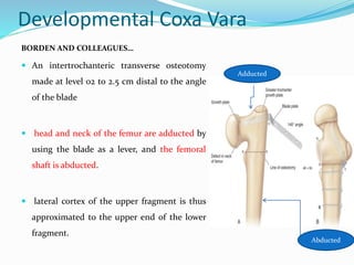 Developmental Coxa Vara
BORDEN AND COLLEAGUES…
 An intertrochanteric transverse osteotomy
made at level o2 to 2.5 cm distal to the angle
of the blade
 head and neck of the femur are adducted by
using the blade as a lever, and the femoral
shaft is abducted.
 lateral cortex of the upper fragment is thus
approximated to the upper end of the lower
fragment.
Adducted
Abducted
 