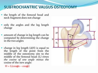 SUBTROCHANTRIC VALGUS OSTEOTOMY
 the length of the femoral head and
neck fragment does not change
 only the angles and the leg length
change
 amount of change in leg length can be
computed by determining the change
in the two angles
 change in leg length (ΔH) is equal to
the length of the point from the
middle of the osteotomy site to the
middle of the femoral head (L) times
the cosine of one angle minus the
cosine of the new angle:
H = L(cos@1 − cos@)
 