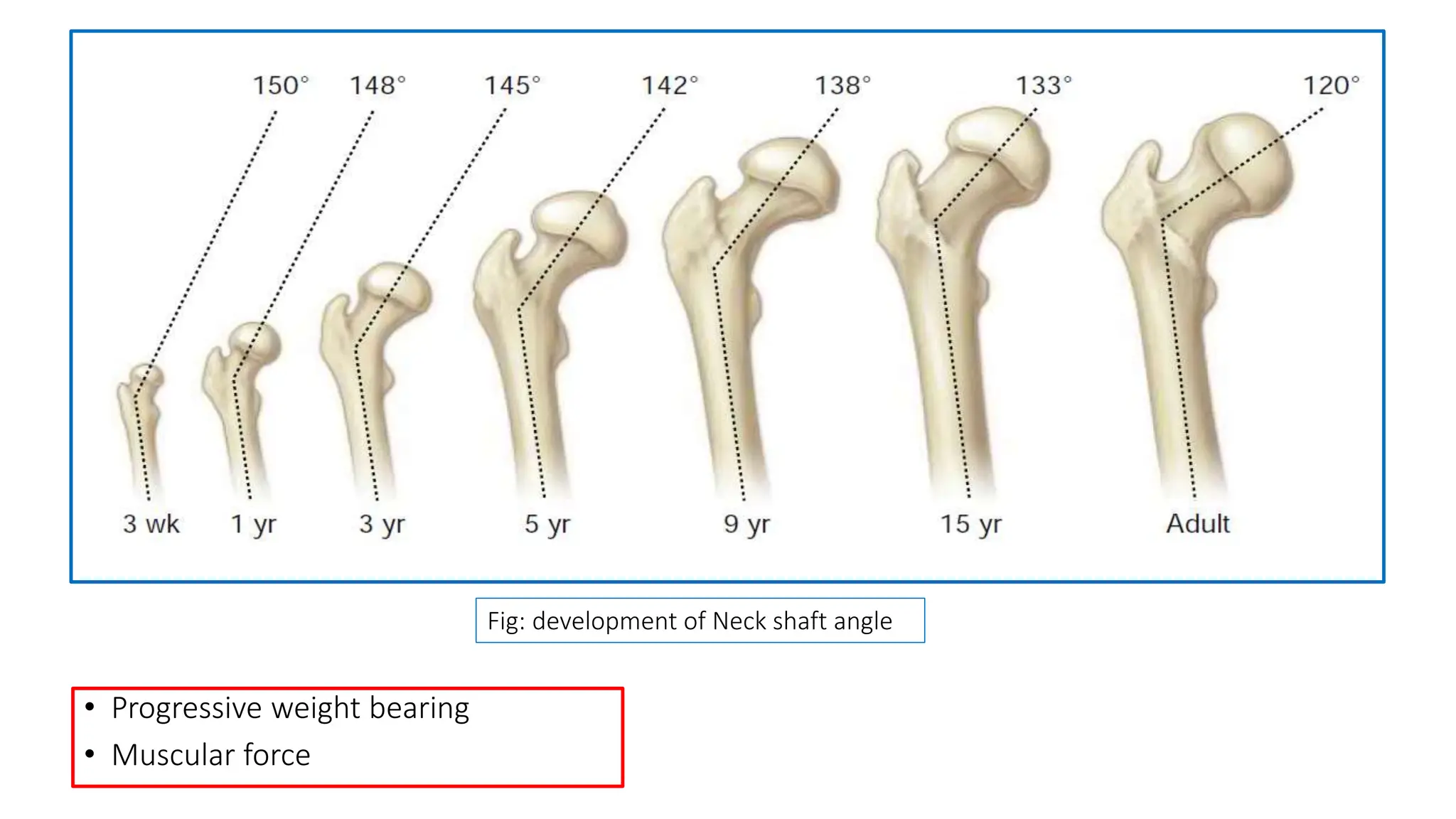 COXA VARA AND COXA VALGA, DEVLOPMENTAL COXA VARA.pptx