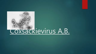 Coxsackievirus A,B.
 