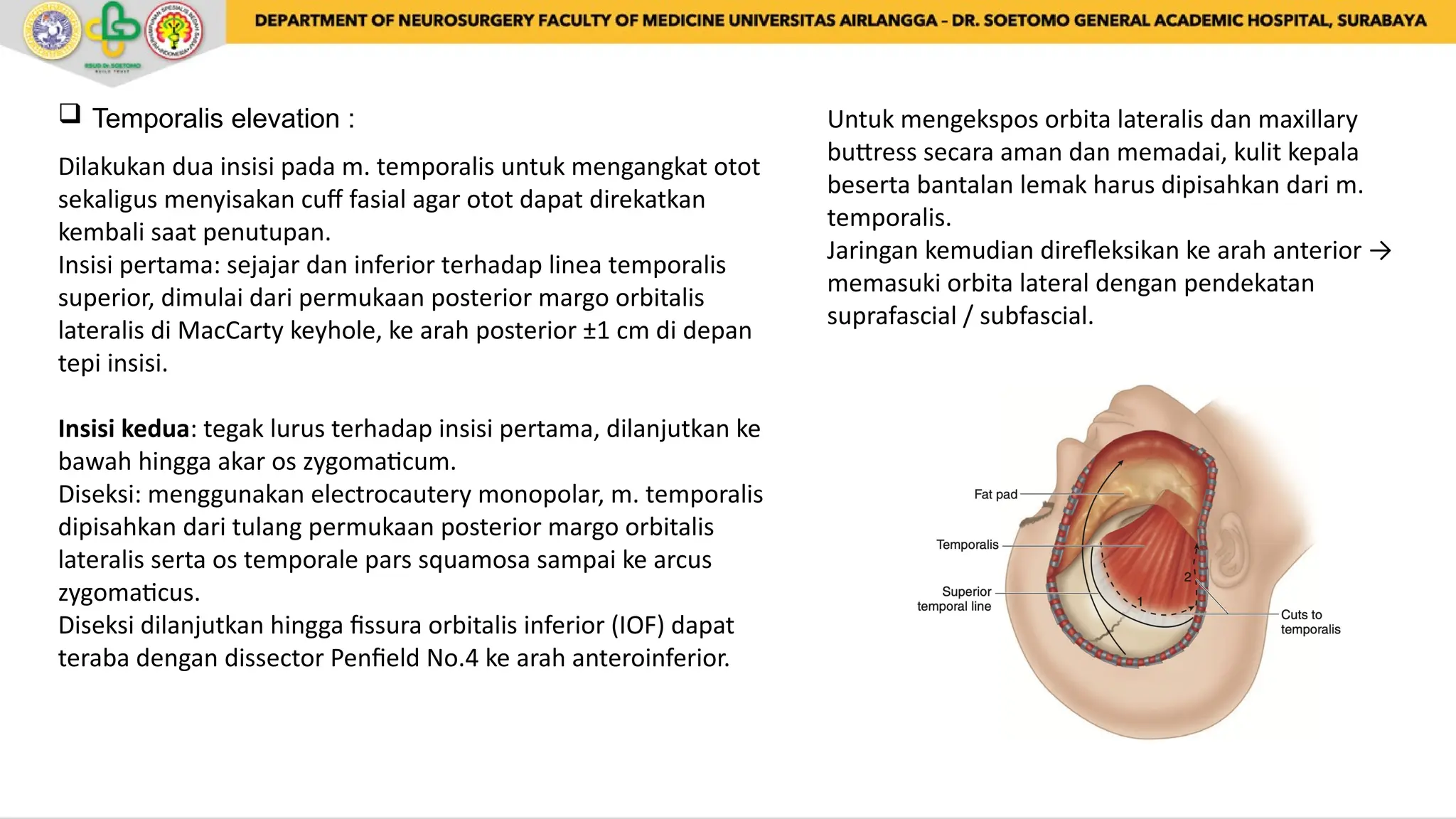 Transbasal Approach Orbitozygomatic Approach in Neurosurgery.pptx