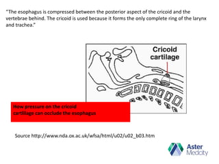 Cricoid pressure -Yes or No? | PPTX