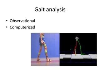 Gait analysis
• Observational
• Computerized
 