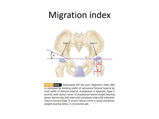 Migration index
 