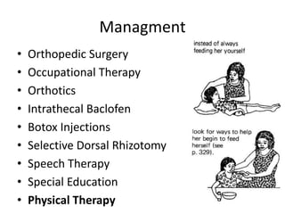 Managment
• Orthopedic Surgery
• Occupational Therapy
• Orthotics
• Intrathecal Baclofen
• Botox Injections
• Selective Dorsal Rhizotomy
• Speech Therapy
• Special Education
• Physical Therapy
 
