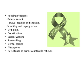 • Feeding Problems:
-Failure to suck.
-Tongue gagging and choking.
-Vomiting and regurgitation.
• Dribbling.
• Constipation.
• Scissor walking
• Toe walking
• Dental carries
• Nystagmus
• Persistence of primitive infantile reflexes
 