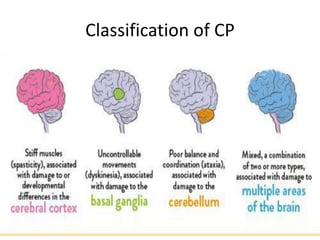 Classification of CP
 