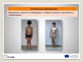 Атипично движение
Движение, което се извършва с повече усилия, отколкото е
необходимо.
 