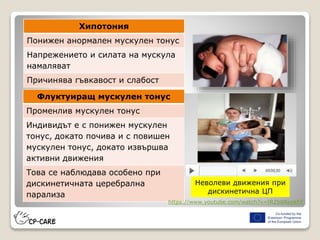 Хипотония
Понижен анормален мускулен тонус
Напрежението и силата на мускула
намаляват
Причинява гъвкавост и слабост
Флуктуиращ мускулен тонус
Променлив мускулен тонус
Индивидът е с понижен мускулен
тонус, докато почива и с повишен
мускулен тонус, докато извършва
активни движения
Това се наблюдава особено при
дискинетичната церебрална
парализа
Неволеви движения при
дискинетична ЦП
https://www.youtube.com/watch?v=tRZb8RepkFE
 