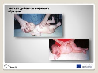 Зона на действие: Рефлексно
обръщане
 