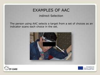 EXAMPLES OF AAC
indirect Selection
The person using AAC selects a target from a set of choices as an
indicator scans each choice in the set.
 