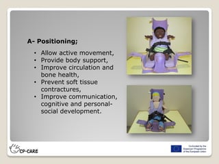 A- Positioning;
• Allow active movement,
• Provide body support,
• Improve circulation and
bone health,
• Prevent soft tissue
contractures,
• Improve communication,
cognitive and personal-
social development.
 