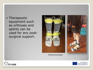  Therapeutic
equipment such
as orthoses and
splints can be
used for any post-
surgical support.
Orthosis Examples
 