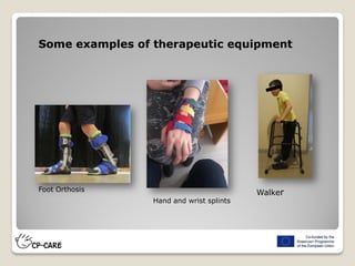 Some examples of therapeutic equipment
Hand and wrist splints
Foot Orthosis Walker
 