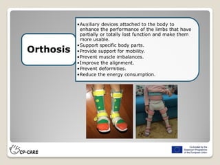•Auxiliary devices attached to the body to
enhance the performance of the limbs that have
partially or totally lost function and make them
more usable.
•Support specific body parts.
•Provide support for mobility.
•Prevent muscle imbalances.
•Improve the alignment.
•Prevent deformities.
•Reduce the energy consumption.
Orthosis
 