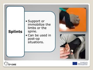 • Support or
immobilize the
limbs or the
spine.
• Can be used in
post-op
situations.
Splints
 