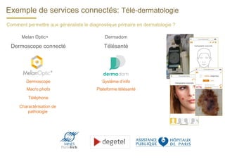 Exemple de services connectés: Télé-dermatologie
Comment permettre aux généraliste le diagnostique primaire en dermatologie ?
Macro photo
Téléphone
Dermoscope
Charactérisation de
pathologie
Melan Optic+
Dermoscope connecté
Dermadom
Télésanté
Plateforme télésanté
Système d’info
 