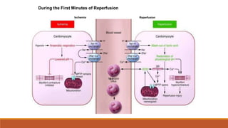 Ischemia Reperfusion
3-1
During the First Minutes of Reperfusion
 