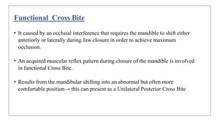 CASE PRESENTATION ON CROSS BITE-A CLINICAL CASE REPORTpptx | PPTX
