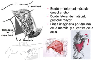 • Borde anterior del músculo
dorsal ancho
• Borde lateral del músculo
pectoral mayor
• Línea imaginaria por encima
de la mamila, y el vértice de la
axila
 