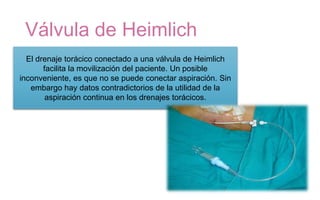 Válvula de Heimlich
El drenaje torácico conectado a una válvula de Heimlich
facilita la movilización del paciente. Un posible
inconveniente, es que no se puede conectar aspiración. Sin
embargo hay datos contradictorios de la utilidad de la
aspiración continua en los drenajes torácicos.
 