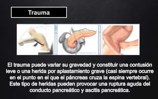 Trauma
 