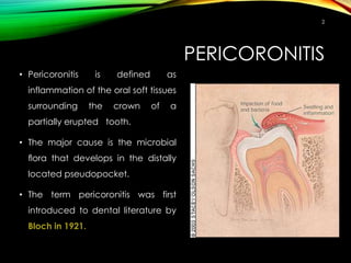 PERICORONITIS
• Pericoronitis is defined as
inflammation of the oral soft tissues
surrounding the crown of a
partially erupted tooth.
• The major cause is the microbial
ﬂora that develops in the distally
located pseudopocket.
• The term pericoronitis was first
introduced to dental literature by
Bloch in 1921.
2
 