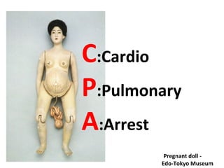 Pregnant doll -
Edo-Tokyo Museum
C:Cardio
P:Pulmonary
A:Arrest
 