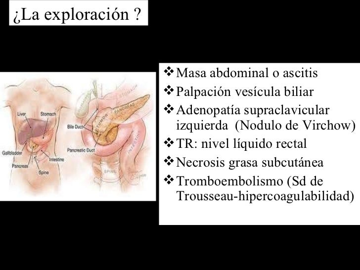 Ca pancreas y diabetes Ca pancreas y diabetes