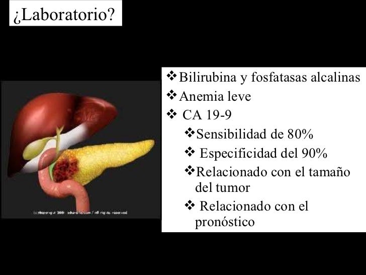 Ca pancreas y diabetes Ca pancreas y diabetes