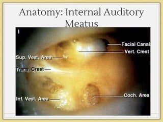 Anatomy: Internal Auditory
Meatus
Rhoton
542I
 