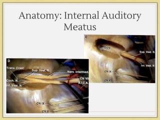 Anatomy: Internal Auditory
Meatus
 