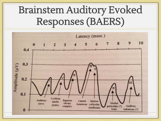 Brainstem Auditory Evoked
Responses (BAERS)
 