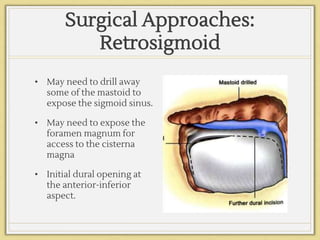 Surgical Approaches:
Retrosigmoid
• May need to drill away
some of the mastoid to
expose the sigmoid sinus.
• May need to expose the
foramen magnum for
access to the cisterna
magna
• Initial dural opening at
the anterior-inferior
aspect.
 