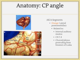 Anatomy: CP angle
AICA Segments
▪ Orange: Lateral
pontomedullary
▪ Related to:
▪ Internal auditory
meatus
▪ CN 7, 8
▪ Choroid plexus
protruding from
foramen of Luska
 
