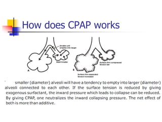 How does CPAP works
 