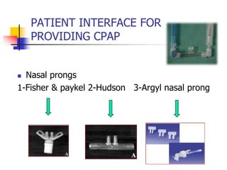 PATIENT INTERFACE FOR
PROVIDING CPAP
 Nasal prongs
1-Fisher & paykel 2-Hudson 3-Argyl nasal prong
 