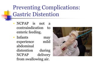 Preventing Complications:
Gastric Distention
• NCPAP is not a
contraindication to
enteric feeding.
• Infants may
experience mild
abdominal
distention during
NCPAP delivery
from swallowing air.
 
