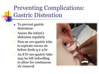 Preventing Complications:
Gastric Distention
 To prevent gastric
distention:
• Assess the infant’s
abdomen regularly
• Pass an oro-gastric tube
to aspirate excess air
before feeds q 2-4 hr
• An 8 Fr oro-gastric tube
may be left indwelling
to allow for continuous
air removal
 