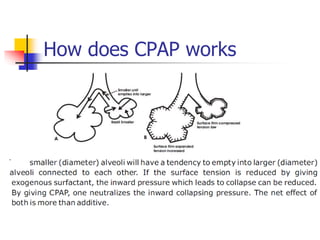 Stretches lung
pleura and upper
airway
 CPAP
Prevents collapse
of alveoli with
marginal stability
Stabilizes the
chest wa...