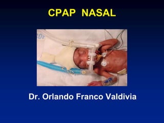 CPAP NASAL
Dr. Orlando Franco Valdivia
 