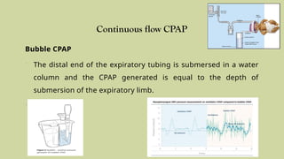 Comprehensive Overview of Continuous Positive Airway Pressure (CPAP) in ...