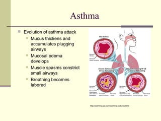 Asthma
 Evolution of asthma attack
 Mucus thickens and
accumulates plugging
airways
 Mucosal edema
develops
 Muscle spasms constrict
small airways
 Breathing becomes
labored
http://asthma-ppt.com/asthma-pictures.html
 