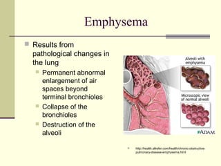 Emphysema
 Results from
pathological changes in
the lung
 Permanent abnormal
enlargement of air
spaces beyond
terminal bronchioles
 Collapse of the
bronchioles
 Destruction of the
alveoli
 http://health.allrefer.com/health/chronic-obstructive-
pulmonary-disease-emphysema.html
 