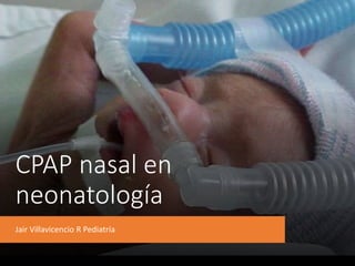CPAP nasal en
neonatología
Jair Villavicencio R Pediatría
 