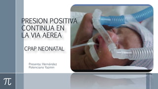 PRESION POSITIVA
CONTINUA EN
LA VIA AEREA
CPAP NEONATAL
Presenta: Hernández
Potenciano Yazmin
 